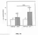 Fig. 15 -  Techniques and compositions for treating cardiovascular disease by in vivo gene delivery