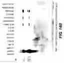 Fig. 33 - Tissue inhibitor of metalloproteinase type three (TIMP-3) composition and methods