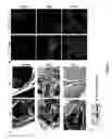 Fig. 06 - Neuronally expressed stem cell factor modulates angiogenesis and neural stem cell migration to areas of brain injury