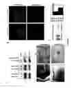 Fig. 07 - Neuronally expressed stem cell factor modulates angiogenesis and neural stem cell migration to areas of brain injury