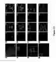 Fig. 19 - Neuronally expressed stem cell factor modulates angiogenesis and neural stem cell migration to areas of brain injury