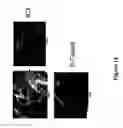 Fig. 25 - Neuronally expressed stem cell factor modulates angiogenesis and neural stem cell migration to areas of brain injury