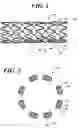 Fig. 02 - Systems for gel-based medical implants