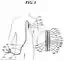 Fig. 06 - Systems for gel-based medical implants