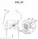 Fig. 15 - Systems for gel-based medical implants