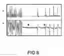 Fig. 09 - Pharmaceutical composition comprising plant material or sp. alone or in association with other plant extracts for the reversion/combat and/or prevention of ventricular fibrillation