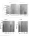 Fig. 09 - Process for granulation of edible seeds