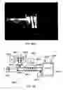Fig. 80 - Boost devices and methods of using them