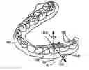 Fig. 01 - Computer automated development of an orthodontic treatment plan and appliance