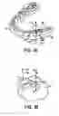 Fig. 02 - Computer automated development of an orthodontic treatment plan and appliance