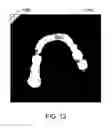 Fig. 20 - Computer automated development of an orthodontic treatment plan and appliance