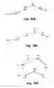 Fig. 23 - Computer automated development of an orthodontic treatment plan and appliance