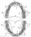 Fig. 01 - Combination set of artificial teeth units for setting-up dentures in balanced articulation