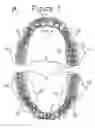Fig. 02 - Combination set of artificial teeth units for setting-up dentures in balanced articulation