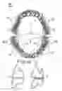 Fig. 03 - Combination set of artificial teeth units for setting-up dentures in balanced articulation