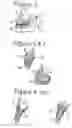 Fig. 04 - Combination set of artificial teeth units for setting-up dentures in balanced articulation