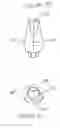Fig. 15 - Dental restorative system and components