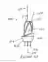 Fig. 19 - Dental restorative system and components