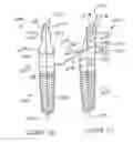 Fig. 24 - Dental restorative system and components