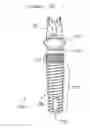 Fig. 29 - Dental restorative system and components
