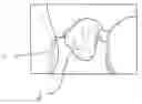 Fig. 01 - Method of preparing dentition for the taking of a dental impression