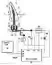 Fig. 01 - Method and extractor for removing a tool fragment from a tooth root canal
