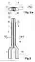 Fig. 03 - Method and extractor for removing a tool fragment from a tooth root canal