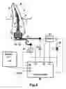 Fig. 06 - Method and extractor for removing a tool fragment from a tooth root canal