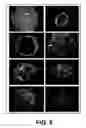 Fig. 06 - Establishment of a human embryonic stem cell line using mammalian cells