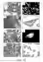 Fig. 13 - Establishment of a human embryonic stem cell line using mammalian cells