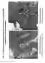 Fig. 10 - Methods and compositions for the detection of cervical disease