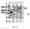 Fig. 11 - Open channel solid phase extraction systems and methods