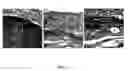 Fig. 02 - Lectin binding to choroidal neovascularization