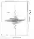 Fig. 06 - Pipetting needle