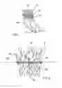 Fig. 02 - Basketball return device