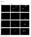 Fig. 10 - Nucleic acids encoding a human PAP1 polypeptide