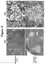 Fig. 10 - Method of use of antagonists of zonulin to prevent the loss of or to regenerate pancreatic cells