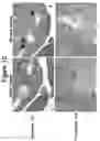 Fig. 11 - Method of use of antagonists of zonulin to prevent the loss of or to regenerate pancreatic cells