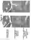 Fig. 12 - Method of use of antagonists of zonulin to prevent the loss of or to regenerate pancreatic cells