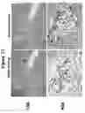 Fig. 13 - Method of use of antagonists of zonulin to prevent the loss of or to regenerate pancreatic cells