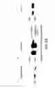 Fig. 32 - Apoptosis-specific eIF-5A and polynucleotides encoding same