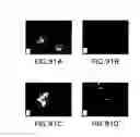 Fig. 91 - Apoptosis-specific eIF-5A and polynucleotides encoding same