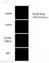 Fig. 10 - Trans-golgi network-associated processes, methods and compositions related thereto