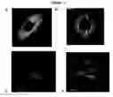 Fig. 03 - Methods for treating parkinsons disease and parkinsonism