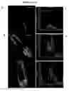 Fig. 04 - Methods for treating parkinsons disease and parkinsonism