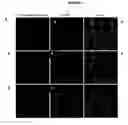 Fig. 06 - Methods for treating parkinsons disease and parkinsonism