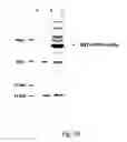 Fig. 19 - Peptide purification by means of metal ion affinity chromatography