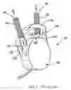 Fig. 02 - Single sac ventricular assist device
