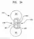 Fig. 04 - Endourethral device & method