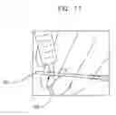 Fig. 14 - Endourethral device & method